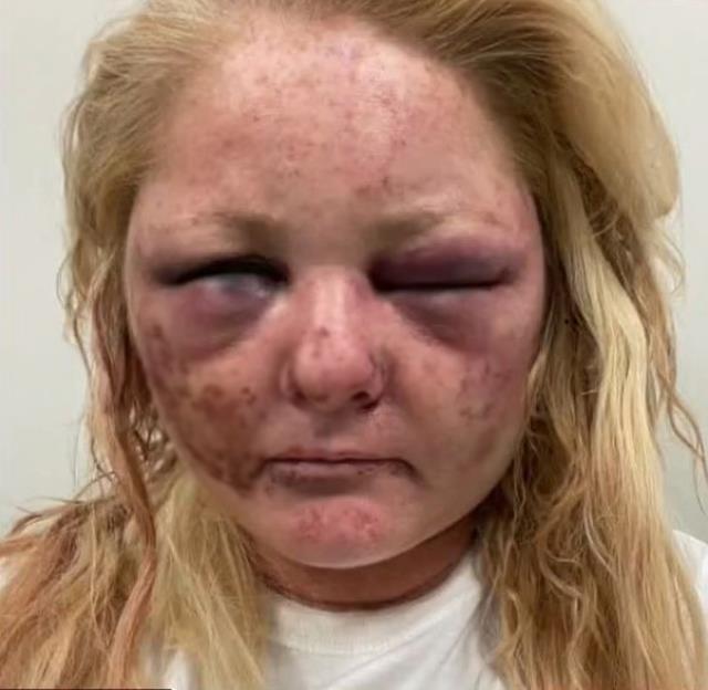 Saldırıya uğrayan genç kadın, sapığın cinsel organını ısırarak tecavüzden kurtuldu